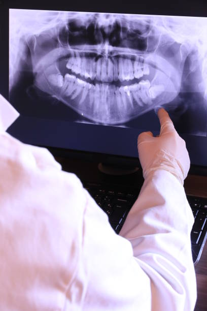 Best Knocked-Out Tooth (Avulsed Tooth) Treatment in Mila Doce, TX