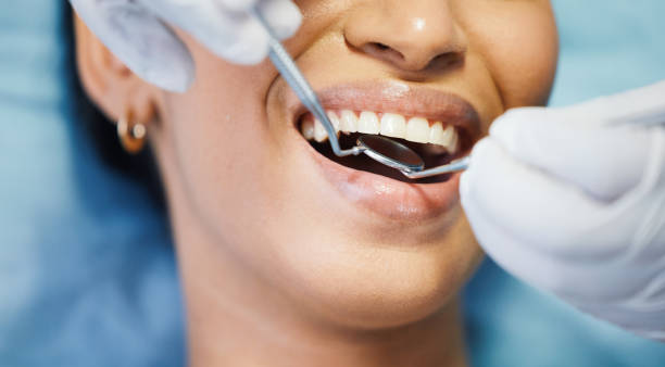Best Emergency Dental Care for Sports Injuries in Mila Doce, TX